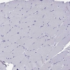 Immunohistochemical staining of human skeletal muscle shows no positivity in myocytes as expected.
