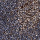 Immunohistochemical staining of human lymph node using Anti-TACO1 antibody HPA021626.