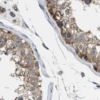 Immunohistochemical staining of human testis using Anti-TACO1 antibody HPA021626.