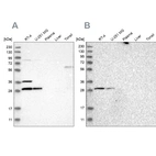Western blot analysis using Anti-TACO1 antibody HPA021626 (A) shows similar pattern to independent antibody HPA021643 (B).