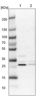 Lane 1: NIH-3T3 cell lysate (Mouse embryonic fibroblast cells)_br/_Lane 2: NBT-II cell lysate (Rat Wistar bladder tumour cells)