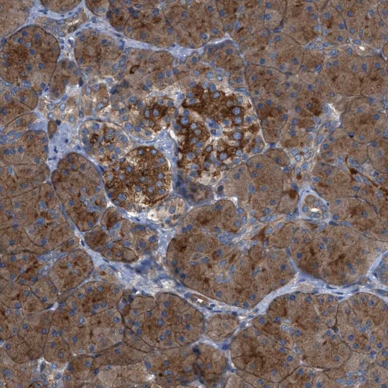 Anti-CYB5D1 Antibody