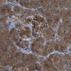 Anti-CYB5D1 Antibody