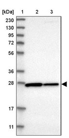 Lane 1: Marker [kDa] 230, 130, 95, 72, 56, 36, 28, 17, 11_br/_Lane 2: Human cell line RT-4_br/_Lane 3: Human cell line U-251MG sp