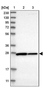 Lane 1: Marker [kDa] 230, 130, 95, 72, 56, 36, 28, 17, 11_br/_Lane 2: Human cell line RT-4_br/_Lane 3: Human cell line U-251MG sp