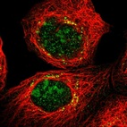 Immunofluorescent staining of human cell line A-431 shows localization to nucleoli & the Golgi apparatus.