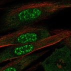 Immunofluorescent staining of human cell line ASC TERT1 shows localization to nuclear speckles & cytosol.