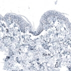 Immunohistochemical staining of human skin shows no positivity in squamous epithelial cells as expected.