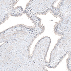 Anti-RCOR2 Antibody