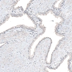 Immunohistochemical staining of human prostate shows no positivity in glandular cells as expected.