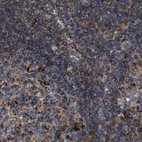 Immunohistochemical staining of human lymph node using Anti-TACO1 antibody HPA021643.
