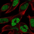 Immunofluorescent staining of human cell line RH-30 shows localization to nucleus.