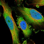 Immunofluorescent staining of human cell line U-251 MG shows localization to cytosol.
