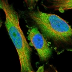 Immunofluorescent staining of human cell line U-251 MG shows localization to cytosol.