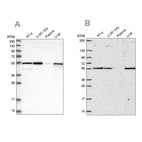Western blot analysis using Anti-PMPCA antibody HPA021648 (A) shows similar pattern to independent antibody HPA063735 (B).