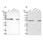 Western blot analysis using Anti-PMPCA antibody HPA021648 (A) shows similar pattern to independent antibody HPA063735 (B).