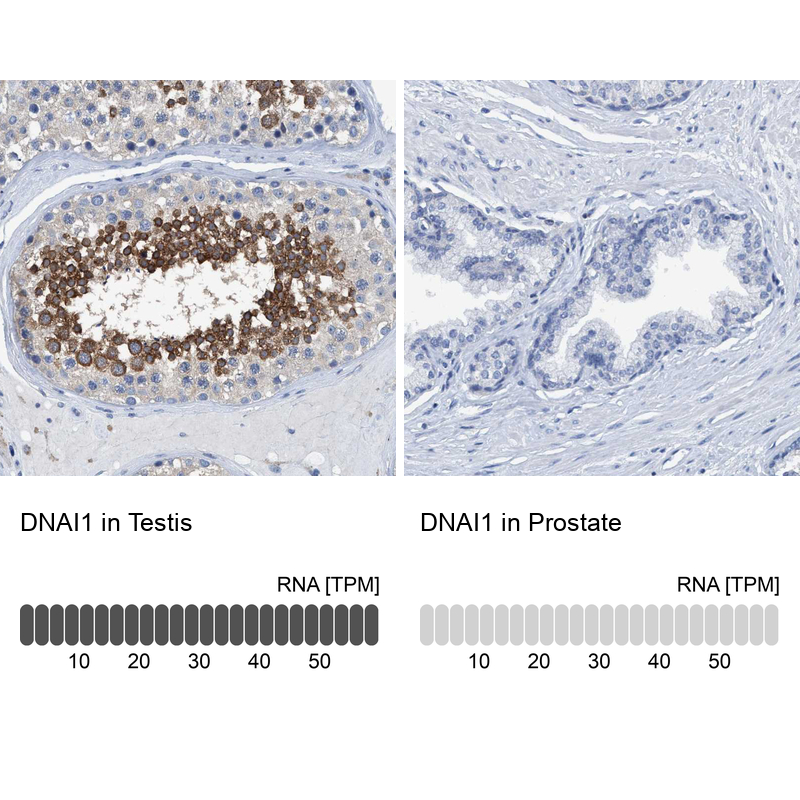 Anti-DNAI1 Antibody