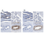 Immunohistochemical staining of human fallopian tube, placenta, prostate and testis using Anti-DNAI1 antibody HPA021649 (A) shows similar protein distribution across tissues to independent antibody HPA021843 (B).