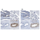 Immunohistochemical staining of human fallopian tube, placenta, prostate and testis using Anti-DNAI1 antibody HPA021649 (A) shows similar protein distribution across tissues to independent antibody HPA021843 (B).