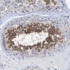 Immunohistochemical staining of human testis shows strong cytoplasmic positivity in cells in seminiferous ducts.
