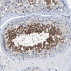 Immunohistochemical staining of human testis shows strong cytoplasmic positivity in cells in seminiferous ducts.