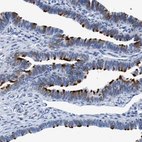 Immunohistochemical staining of human Fallopian tube shows strong positivity in cilia in glandular cells.