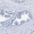 Immunohistochemical staining of human prostate shows no positivity in glandular cells as expected.