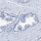 Immunohistochemical staining of human prostate shows no positivity in glandular cells as expected.