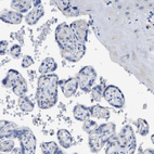 Immunohistochemical staining of human placenta shows no positivity in trophoblastic cells as expected.