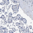 Immunohistochemical staining of human placenta shows no positivity in trophoblastic cells as expected.