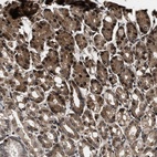 Anti-ACCS Antibody
