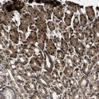 Anti-ACCS Antibody