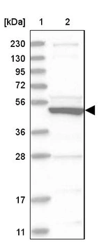 Lane 1: Marker [kDa] 230, 130, 95, 72, 56, 36, 28, 17, 11_br/_Lane 2: Human cell line RT-4