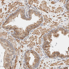 Immunohistochemical staining of human prostate moderate positivity in nuclear membrane with moderate cytoplasmic positivity in glandular cells and smooth muscle cells.