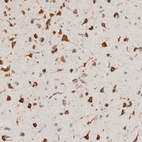 Immunohistochemical staining of human cerebral cortex shows strong cytoplasmic positivity in neuronal cells.