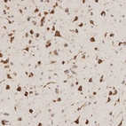 Immunohistochemical staining of human cerebral cortex shows strong cytoplasmic positivity in neuronal cells.