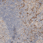 Immunohistochemical staining of human tonsil shows strong positivity in nuclear membrane in non-germinal center cells in addition to moderate cytoplasmic positivity.