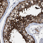 Immunohistochemical staining of human testis shows strong cytoplasmic positivity in cells in seminiferous ducts.