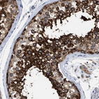 Immunohistochemical staining of human testis shows strong cytoplasmic positivity in cells in seminiferous ducts.