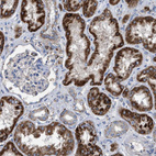 Immunohistochemical staining of human kidney shows strong cytoplasmic positivity in cells in tubules.