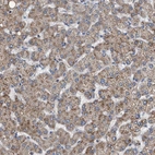Immunohistochemical staining of human liver shows moderate cytoplasmic positivity in hepatocytes.