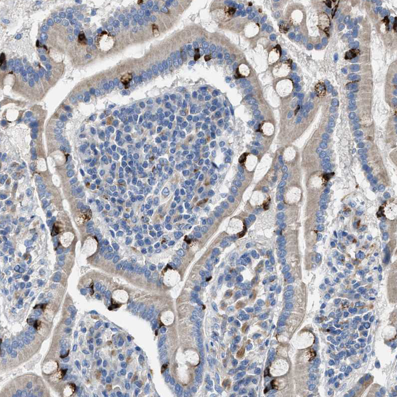 Anti-AOAH Antibody