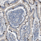 Anti-AOAH Antibody