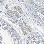 Immunohistochemical staining of human testis shows weak cytoplasmic positivity in Leydig cells.