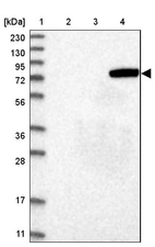 Lane 1: Marker [kDa] 230, 130, 95, 72, 56, 36, 28, 17, 11_br/_Lane 2: Human cell line RT-4_br/_Lane 3: Human cell line U-251MG sp_br/_Lane 4: Human plasma (IgG/HSA depleted)