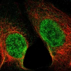 Immunofluorescent staining of human cell line A-431 shows localization to nucleoplasm.