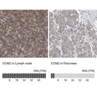 Anti-CCM2 Antibody