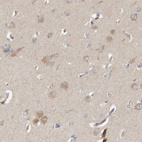 Immunohistochemical staining of human cerebral cortex shows weak cytoplasmic positivity in neurons.