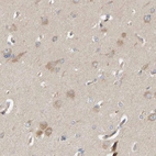Immunohistochemical staining of human cerebral cortex shows weak cytoplasmic positivity in neurons.