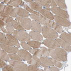 Immunohistochemical staining of human skeletal muscle shows moderate cytoplasmic positivity in myocytes.